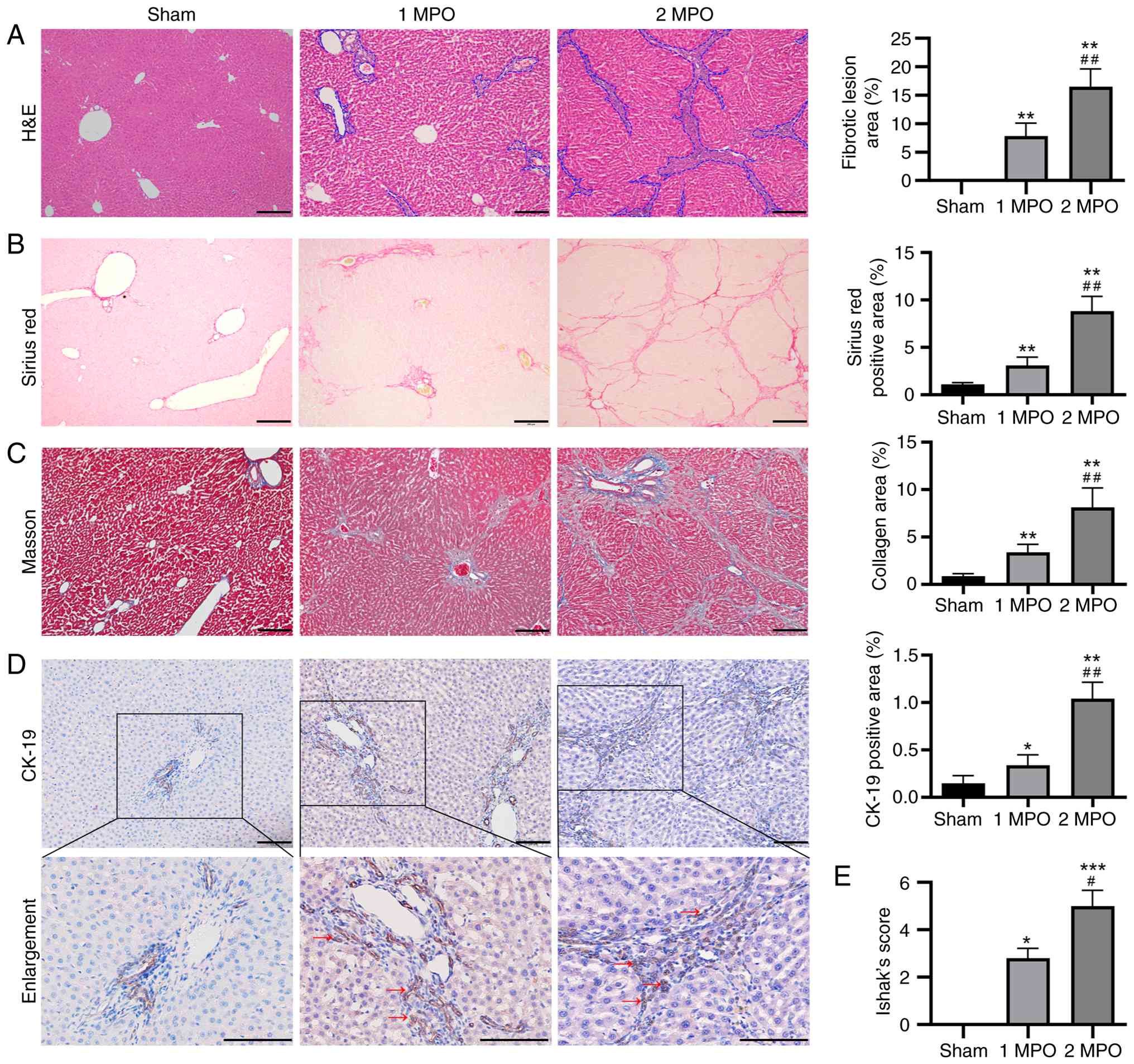 Histopathological changes of rat
livers following partial common bile duct ligation. Representative
images and histopathological analysis by (A) H&E staining, (B)
Sirius red staining and (C) Masson's trichrome staining (scale bar,
200 µm; magnification, x100). (D) CK-19 immunostaining (scale bar,
100 µm; magnification, x100). (E) Ishak's scores of hepatic
fibrosis based on the staining results. Blue dashed lines demarcate
fibrotic tissue boundary. Red arrows demarcate pseudo bile ducts in
Fig. 3D. All values are presented
as the mean ± standard deviation (n=10). *P<0.05,
**P<0.01 or ***P<0.001 vs. the sham
group; #P<0.05 or ##P<0.01 vs. the 1
MPO group. H&E, hematoxylin and eosin; CK-19, cytokeratin 19;
MPO, month post operation.