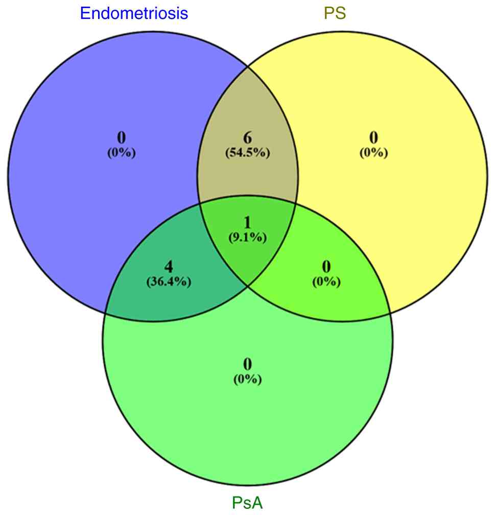 Venn diagram of endometriosis, PS and
PsA shared susceptibility genes. (Core Graphic Module by Vijayaraj
Nagarajan, and Web implementation by Mehdi Pirooznia. October 2006,
usm.edu; https://www.bioinformatics.org/gvenn/). PS,
psoriasis; PsA, psoriatic arthritis.