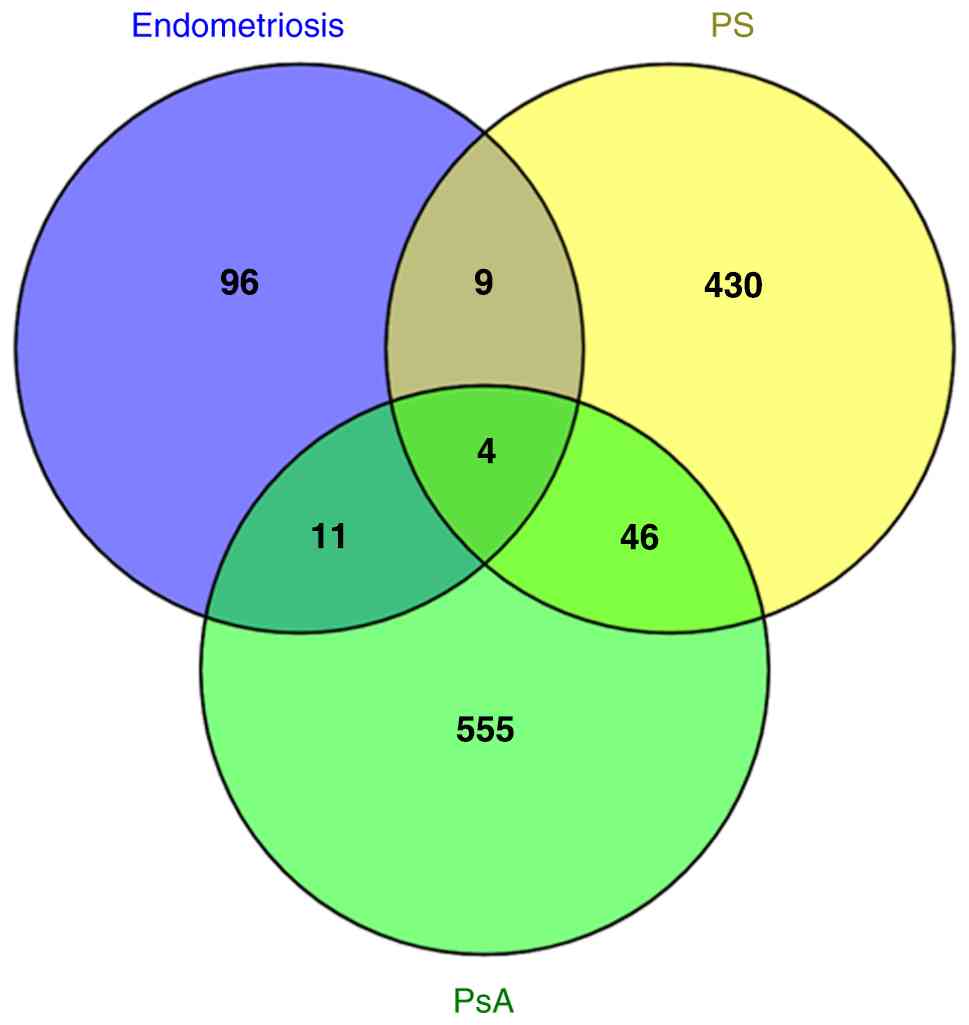 Venn diagram presenting the shared
genes that are upregulated in endometriosis, PS and PsA (219). PS, psoriasis; PsA, psoriatic
arthritis.