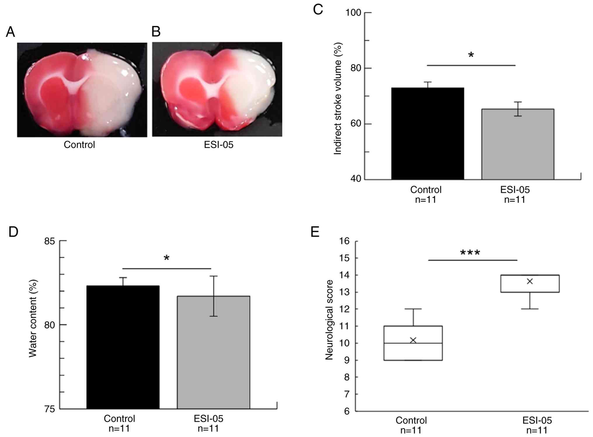 Selective exchange protein directly
activated by cAMP 2 inhibitor (ESI-05) administration decreases
acute permanent cerebral infarcts in rats. (A) Control group. (B)
ESI-05 group. Brains were extracted 24 h after ischemia and
subjected to 2,3,5-triphenyltetrazolium chloride staining to
visualize live mitochondria during the sacrifice process. Necrotic
tissue was distinguished in all images by the lack of red staining,
signifying the presence of non-metabolically active mitochondria at
the time of sacrifice. (C-E) Quantification of lesion size in the
middle cerebral artery occlusion model. Effects of ESI-05 treatment
on (C) infarct volume (% indirect) and (D) brain water content in
the left cerebral hemisphere at 24 h after cerebral infarction. (E)
Effects of ESI-05 treatment on the neurological score 24 h after
ischemia. Sham, no data; control group, n=11; and ESI-05 group,
n=11. Data are presented as the mean ± standard deviation of the
mean for infarct volume and brain water content. Data are presented
as the median and interquartile range for neurological score.
*P<0.05, ***P<0.001. ESI-05,
1,3,5-trimethyl-2-[(4-methylphenyl)sulfonyl]-benzene.