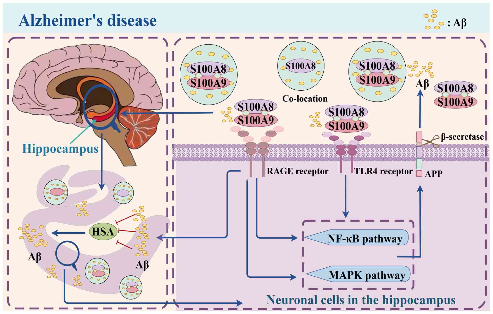 Mechanistic role of S100A8/A9 in AD
pathology within the hippocampus. S100A8/A9 interacts with RAGE and
TLR4 receptors on neuronal cells, leading to the activation of
intracellular signaling pathways such as NF-κB and MAPK. The
activation of these pathways results in the release of inflammatory
mediators like TNF-α and IL-6. Additionally, S100A8/A9 influences
Aβ production by interacting with APP processing and β-secretase.
The co-location of S100A8/A9 with Aβ plaques and its impact on
neurodegenerative changes and synaptic dysfunction in the
hippocampus are also highlighted. AD, Alzheimer's disease; RAGE,
receptor for advanced glycation end products; TLR4, Toll-like
receptor 4; NF-κB, nuclear factor κ-light-chain-enhancer of
activated B cells; MAPK, mitogen-activated protein kinase; TNF-α,
tumor necrosis factor α; IL-6, interleukin 6; Aβ, amyloid-β; APP,
amyloid precursor protein; HSA, human serum albumin.