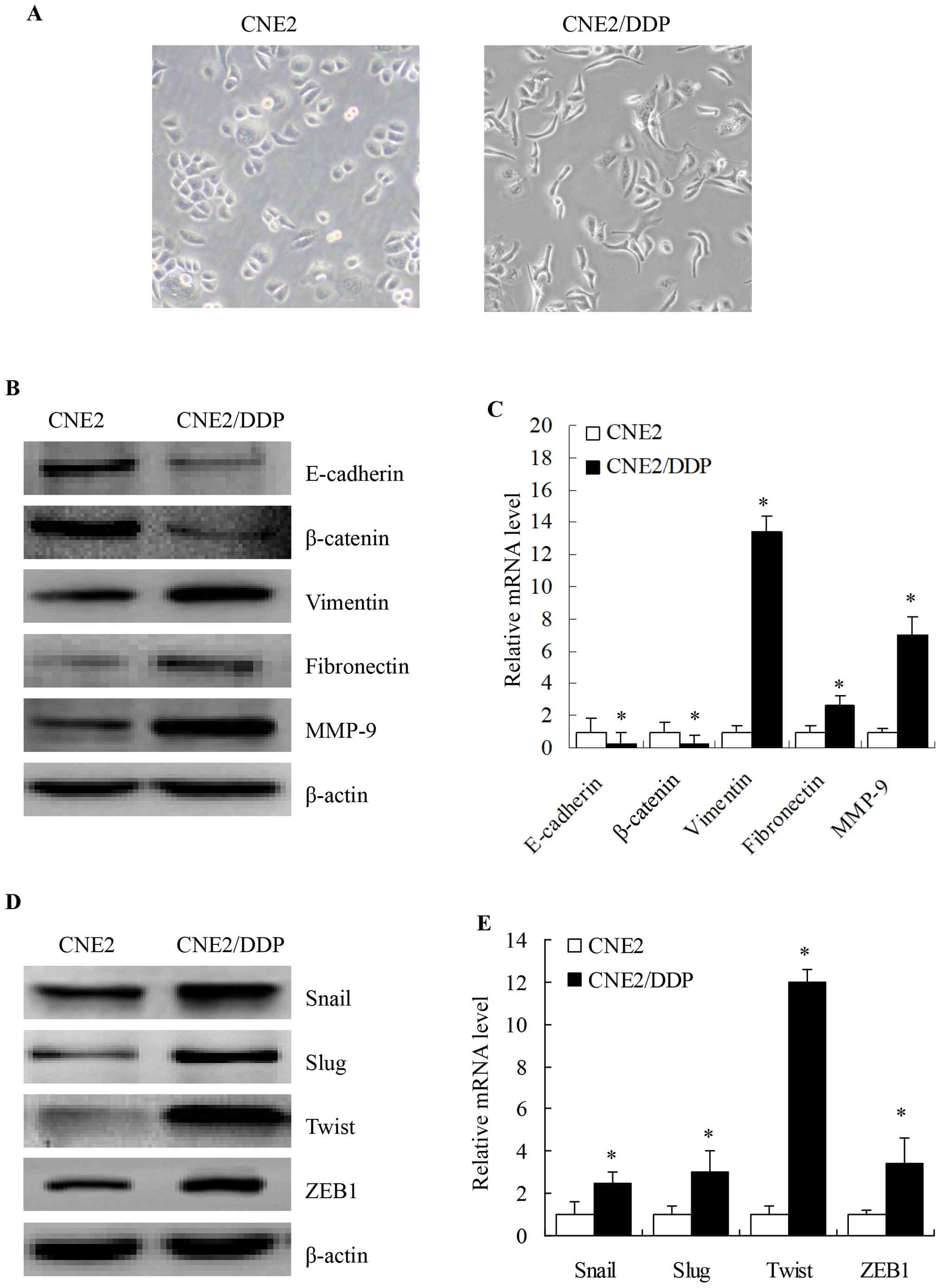 Cisplatin (DDP)-treated CNE2 cells
underwent an epithelial-mesenchymal transition (EMT)-like
transformation. (A) Cell morphology was observed by microscopy at
x200 magnification. Parental CNE2 cells showed an epithelioid,
cobblestone appearance, similar to HNE1 cells. By contrast, the
morphology of CNE2/DDP cells was of mixed type, showing an
epithelioid, long, spindle/fibroblastic pattern with pseudopodia
and an unorganized growth pattern. (B) Expression levels of the
EMT-related proteins, E-cadherin, β-catenin, vimentin, fibronectin
and matrix metalloproteinase (MMP)-9, were determined by western
blot analysis. The downregulation of E-cadherin and β-catenin and
upregulation of vimentin, fibronectin and MMP-9 was observed in
CNE2/DDP cells. (C) mRNA expression levels of E-cadherin,
β-catenin, vimentin, fibronectin and MMP-9 genes were analyzed by
qRT-PCR (means ± SEM, n=3, *P<0.05 compared with the
parental CNE2 cells). (D) Increased protein levels of the
EMT-related transcription factors, Snail, Slug, Twist and zinc
finger E-box binding homeobox 1 (ZEB1), were determined by western
blot analysis. (E) mRNA expression levels for genes coding for the
EMT-related transcription factors, Snail, Slug, Twist and ZEB1,
were analyzed by qRT-PCR (means ± SEM, n=3, *P<0.05
compared with parental CNE2 cells).