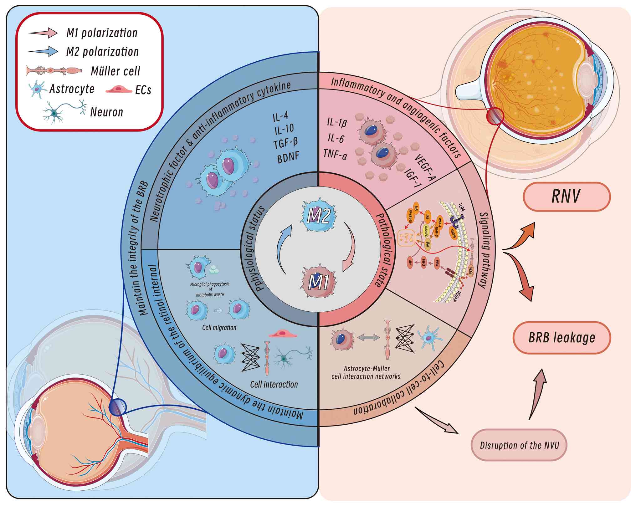 Mechanisms of vascular and neuronal
modulation of retinal microglia in DR. Under physiological
conditions, M2 polarization dominates, releasing anti-inflammatory
and neurotrophic factors such as IL-4, IL-10, TGF-β and BDNF.
Microglia maintain retinal homeostasis via phagocytosis of
metabolic waste, cell migration and interactions with Müller and
astrocytes, preserving the BRB. In pathological states, M1
polarization prevails, producing pro-inflammatory and angiogenic
factors, including IL-1β, IL-6, TNF-α, VEGF-A and IGF-1. These
factors disrupt the BRB, causing BRB leakage and RNV. The imbalance
between M1 and M2 polarization also disrupts cellular interactions,
retinal homeostasis and the neurovascular-immune network,
ultimately damaging the NVU. DR, diabetic retinopathy; BDNF,
brain-derived neurotrophic factor; BRB, blood-retinal barrier; RNV,
retinal neovascularization; IGF-1, insulin-like growth factor 1;
NVU, neurovascular unit.