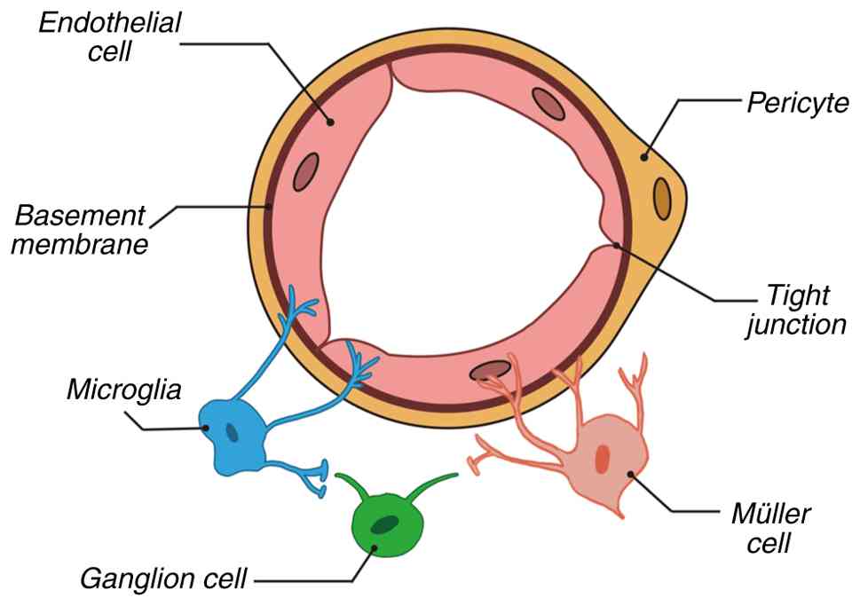 Composition of neurovascular unit.
The neurovascular unit comprises endothelial cells, pericytes,
basement membrane, tight junctions, microglia, Müller cells and
ganglion cells, which together maintain retinal homeostasis.
Endothelial cells line blood vessels and form tight junctions
regulating substance exchange. Pericytes embedded in the basement
membrane support vascular stability. Microglia serve as resident
immune cells, while Müller cells provide metabolic and structural
support to neurons. Ganglion cells transmit visual information.
Collectively, these components regulate the blood-retinal barrier,
blood flow and support neuronal function.