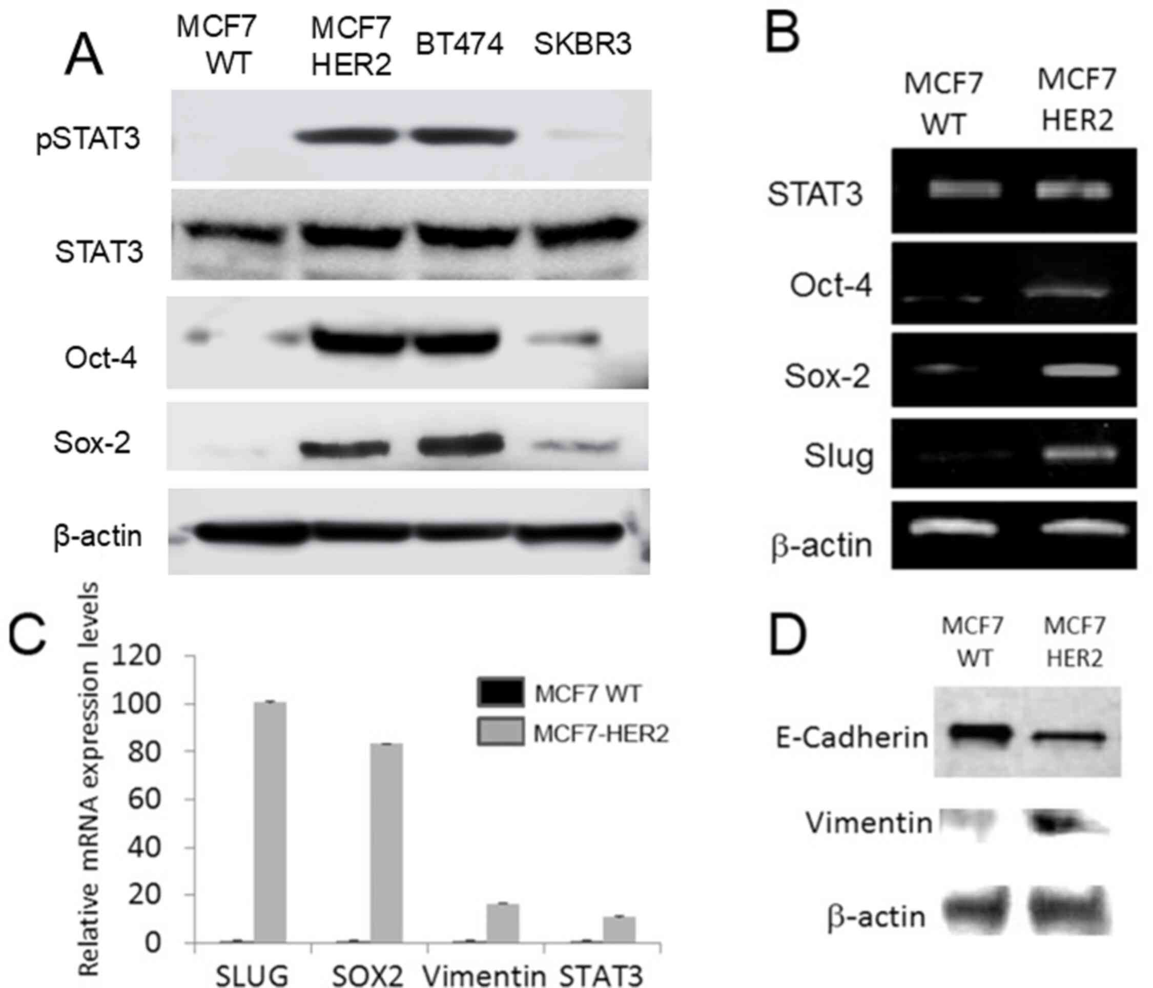 HER2 overexpression induced pSTAT3 and
stem cell marker expression in ER-dependent manner. (A) Western
blot analyses revealed that HER2 overexpression induced pSTAT3 and
stem cell marker expression in MCF7-HER2. (B) RT-PCR confirmed that
HER2 overexpression upregulated stem cell markers of Oct-4, Sox-2
and EMT driver slug in MCF7-HER2. (C) qPCR data showed the
upregulation of CD44, vimentin, Oct-4 and Sox-2 in MCF7-HER2 cell
line. (D) Western blot analyses with down-regulation of epithelial
marker E-cadherin and upregulation of mesenchymal marker vimentin
in MCF7-HER2.