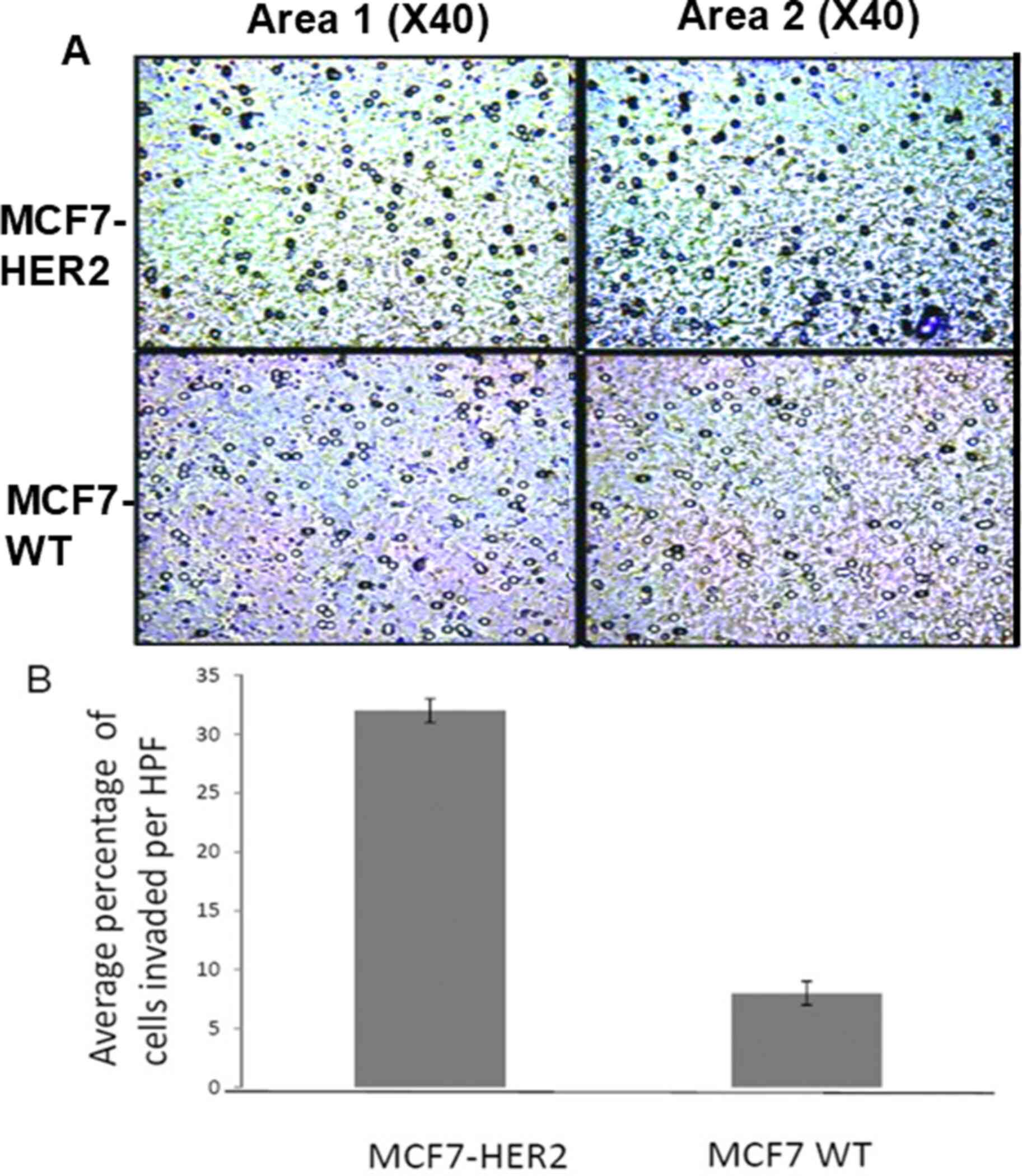 HER2 overexpressed cells display
enhanced cell invasiveness in vitro. To measure the cell
invasiveness of MCF7 WT and MCF7-HER2, cells were subjected to
Boyden chamber assay. After 72 h of incubation, invaded cells were
monitored and counted in 2 independent areas. (A) Results of Boyden
chamber invasion assay was organized into two different microscopic
fields (×40) depicting invaded MCF7 cells. Bluish-black cells by
Toluidine blue indicate that the cell has invaded into the
matrigel. (B) Graphic representation showing increased cell
invasiveness in MCF7-HER2 cells compared to MCF7 WT cells based on
the average number of cells invaded per high powered field (HPF).
MCF7 WT averaged 8.3% invaded per HPF, while MCF7-HER2 averaged
31.3% invaded cells (p<0.05).