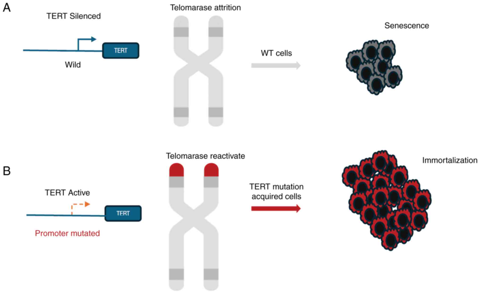 Mutant TERT promoter, which is found
in the majority of anaplastic thyroid cancer cells. (A) Normal
cells that do not express TERT shorten their telomeres
progressively with each cellular division. (B) By contrast, in
tumor cells with TERT promoter mutations, TERT is activated, and
telomeres are maintained, facilitating cellular immortality. The
figure generated by Microsoft® PowerPoint (version
16.9.3; Microsoft Corporation). TERT, telomerase reverse
transcriptase; WT, wild-type.