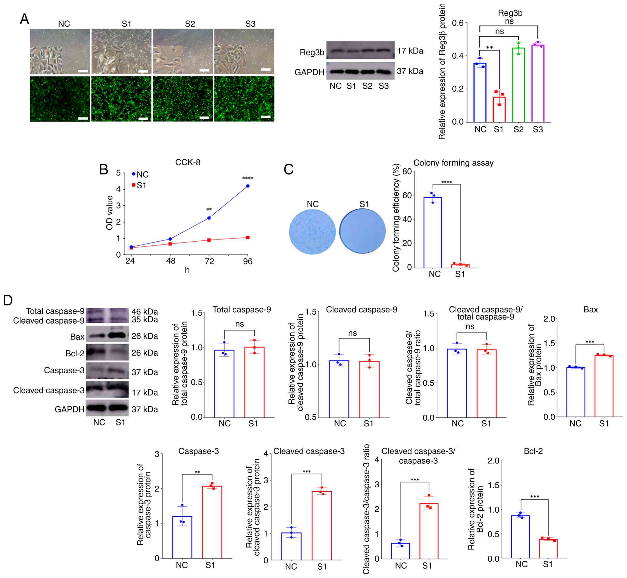Western blot analysis of Reg3β
expression, proliferation and apoptosis after Reg3β knockdown. (A)
Clear cell death was observed with the S1 sequence, which exhibited
the most effective knockdown compared with the other two sequences.
One-way analysis of variance was used to compare these groups
followed by Dunnett's post hoc test. Scale bar, 100 µm. (B) CCK-8
assay revealed that the proliferation of chondrocytes was inhibited
after 72 h. (C) A colony formation assay with Alcian blue staining
revealed that few cells remained after 1 week of S1 infection. (D)
Cleaved caspase-3 and caspase-3, along with Bax, were increased
after Reg3β knockdown at 72 h, whereas the level of Bcl-2 was
significantly decreased, and the level of caspase-9 remained
essentially unchanged. Student's t-tests were conducted to assess
the statistical difference between the two groups in Fig. 2B-D. **P<0.01 and ***P<0.001.
Reg3β, regenerating islet-derived protein 3-β; CCK-8, Cell Counting
Kit-8; NC, negative control; OD, optical density.