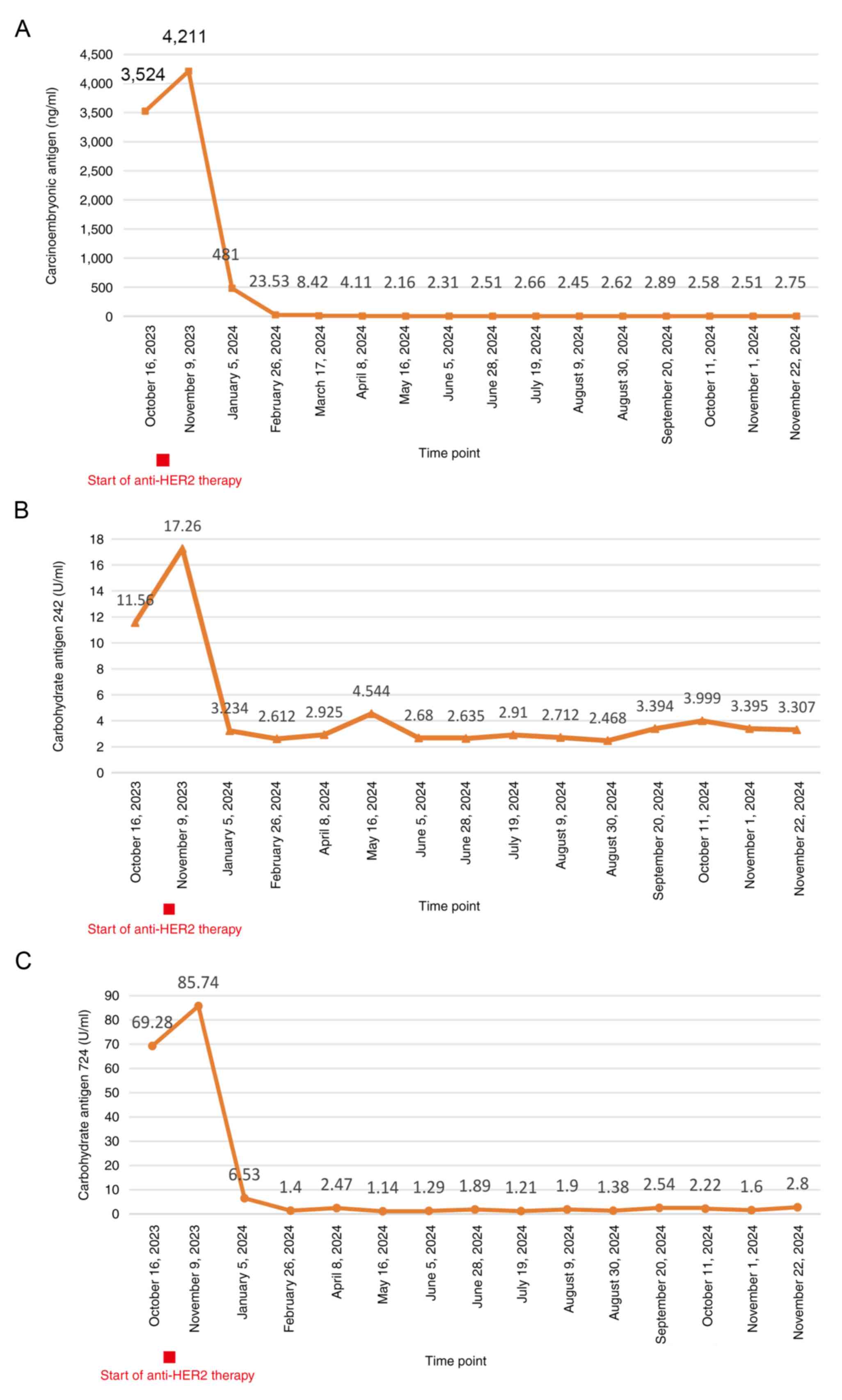 Changes in tumor markers during
treatment. Time course of the changes in (A) carcinoembryonic
antigen (normal level, <5.5 ng/ml), (B) carbohydrate antigen 242
(normal level, <6.9 U/ml) and (C) carbohydrate antigen 724
(normal level, <6.9 U/ml).