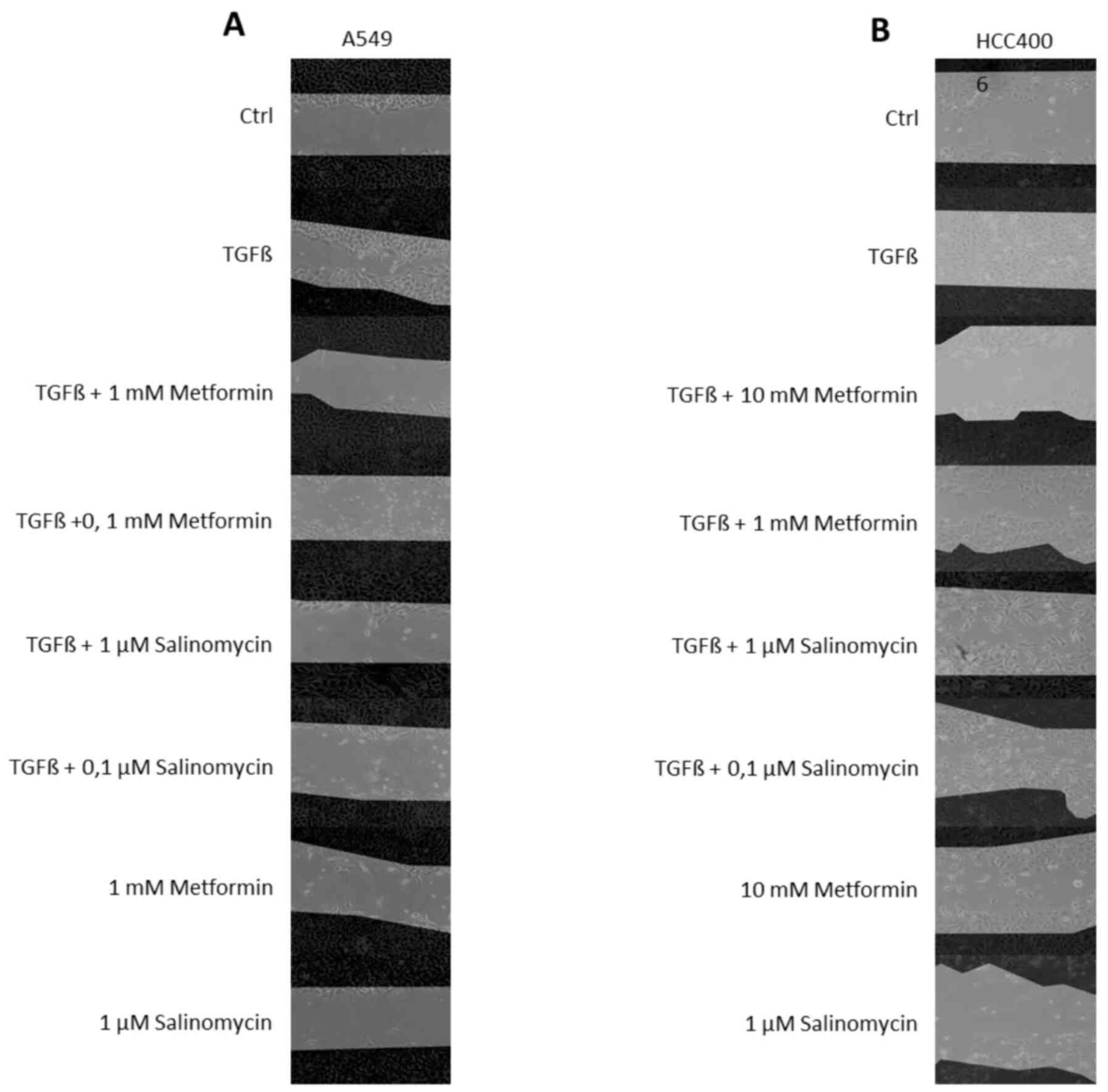Representative images of scratch-wound
assays conducted on the (A) A549 and (B) HCC4006 cell lines after
48 h. Images were captured at 0 h and 48 h after scratching. The
dark areas represents the cell monolayer at the beginning of the
experiment. TGFβ, transforming growth factor β.
