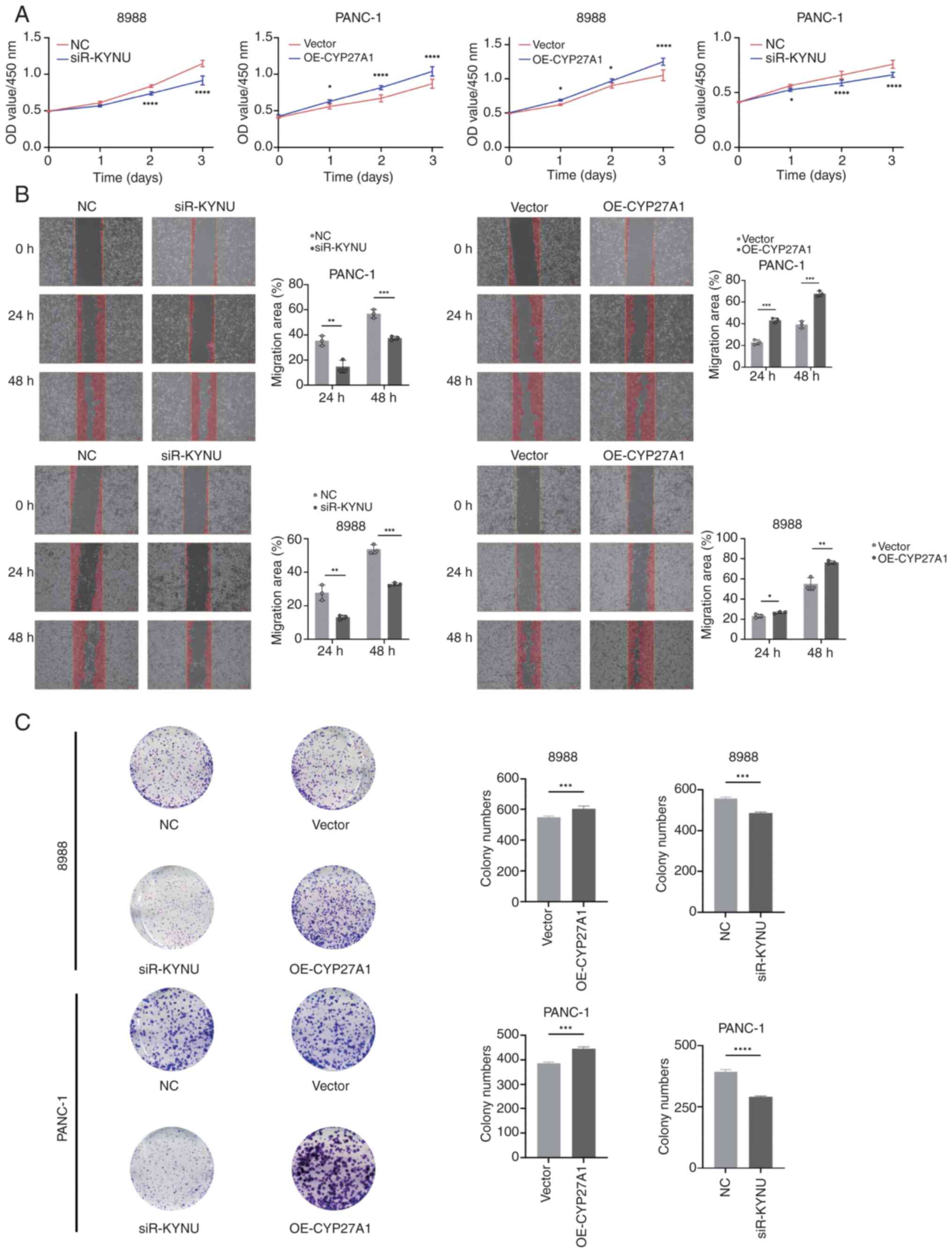 Functional roles of KYNU and CYP27A1
in PDAC progression. (A) Cell Counting Kit-8 assay evaluating the
effects of KYNU knockdown and CYP27A1 overexpression on PDAC cell
proliferation. *P<0.05; **P<0.01; ***P<0.001;
****P<0.0001. (B) Scratch assay assessing KYNU knockdown and
CYP27A1 overexpression on cell migration (4X). (C) Colony formation
assay detecting changes in cell proliferation after KYNU knockdown
and CYP27A1 overexpression. *P<0.05; **P<0.01; ***P<0.001;
****P<0.0001. KYNU, Kynureninase; CYP27A1, Cytochrome P450
Family 27 Subfamily A Member 1; PDAC, pancreatic ductal
adenocarcinoma; OD, optical density; NC, negative control; siR,
small interfering RNA; OE, overexpression.