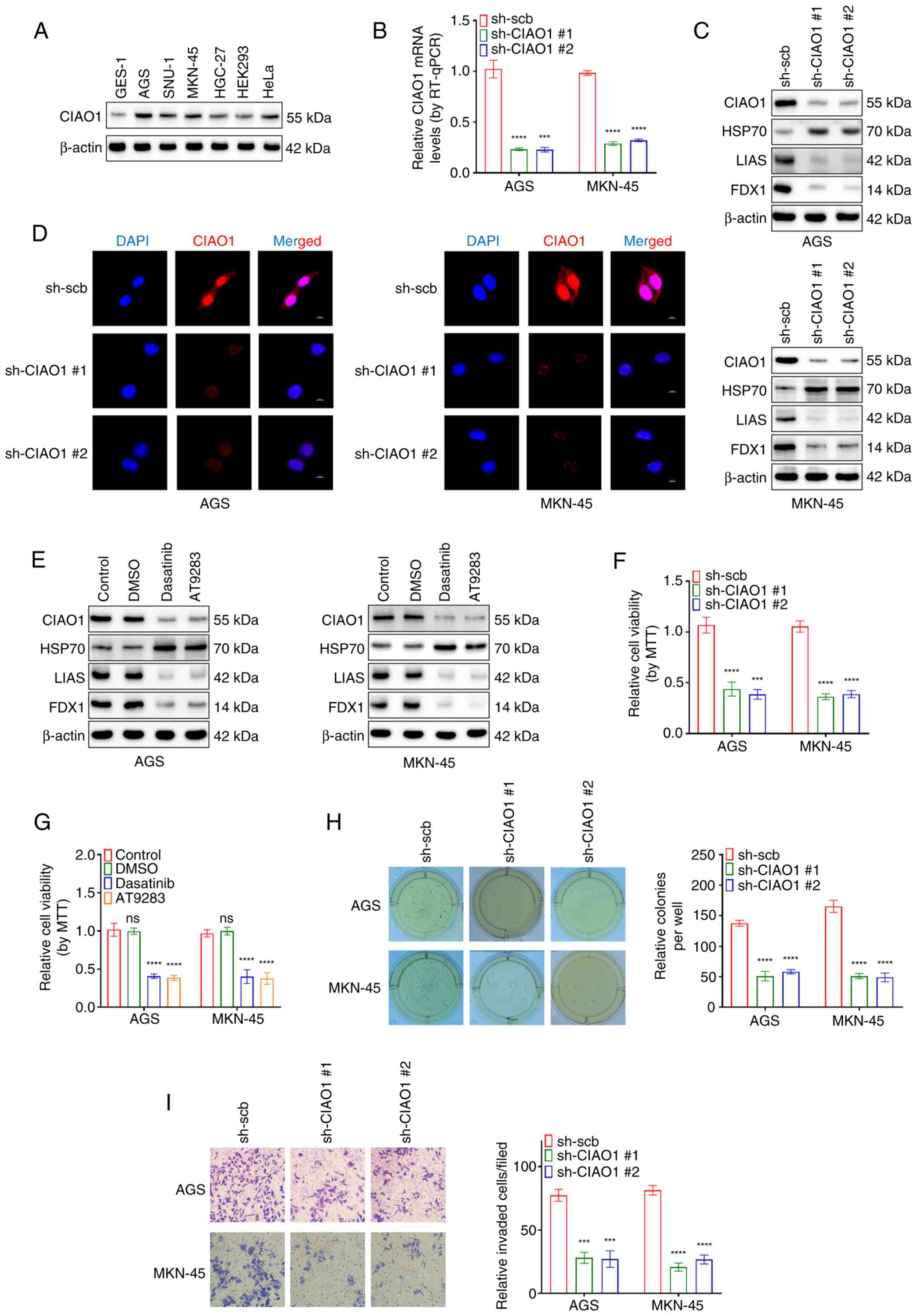Pharmacological inhibition of CIAO1
induces cuproptosis and inhibits the aggressiveness of cancer
cells. (A) Western blot analysis revealed the expression of CIAO1
in GES 1, AGS, SNU 1, MKN 45, HGC 27, HEK293 and HeLa cell lines.
(B) RT-qPCR assays (normalized to βactin) demonstrated the
CIAO1 expression levels, (C) western blot analysis revealed
the CIAO1, FDX1, LIAS and HSP70 expression levels and (D)
immunofluorescence assays demonstrated the localization and
fluorescence intensity of CIAO1 expression (scale bar, 10 µm) in
AGS and MKN-45 cells transfected with sh-Scb, sh-CIAO1 #1 or
sh-CIAO1 #2. (E) Western blot analysis revealed the CIAO1,
FDX1, LIAS and HSP70 expression levels in AGS and MKN-45 cells
treated with dasatinib (0.5 nmol/l) or AT-9283 (4 nmol/l). MTT
colorimetric assays demonstrated changes in the viability of AGS
and MKN-45 cells (F) transfected with sh-Scb, sh-CIAO1 #1 or
sh-CIAO1 #2 and (G) treated with dasatinib (0.5 nmol/l) or
AT9283 (4 nmol/l). Representative images (left panels) and
quantification of the data (right panels) of (H) soft agar and (I)
Matrigel invasion assays, demonstrated the anchorage-independent
proliferation and invasion of AGS and MKN-45 cells stably
transfected with sh-Scb, sh-CIAO1 #1 or sh-CIAO1 #2.
Magnification, ×100. ***P<0.001; ****P<0.0001 vs.
sh-Scb. CIAO1, cytosolic iron-sulfur assembly component 1;
RT-qPCR, reverse transcription-quantitative PCR; sh, short hairpin;
Scb, scramble; FDX1, ferredoxin 1; LIAS, lipoic acid synthetase;
HSP70, heat shock protein 70; ns, not significant.