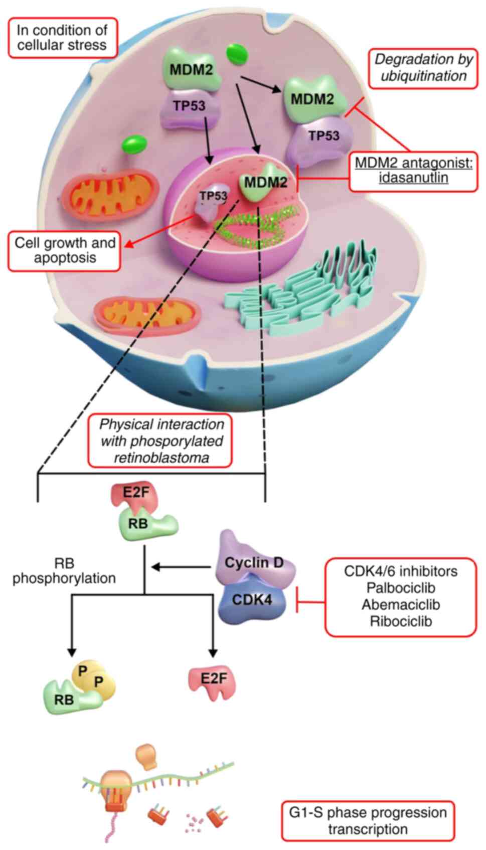 MDM2 and CDK4 involvement in the
pathogenesis of liposarcoma. CDK4 gene amplification results in
increased expression of the CDK4 protein, which promotes RB
phosphorylation, thereby driving cell-cycle progression. MDM2
negatively regulates p53 through various mechanisms, inhibiting p53
transcription and facilitating p53 degradation by ubiquitination.
MDM2, murine double minute 2; RB, retinoblastoma; CDK4,
cyclin-dependent kinase 4; P, phosphorus.