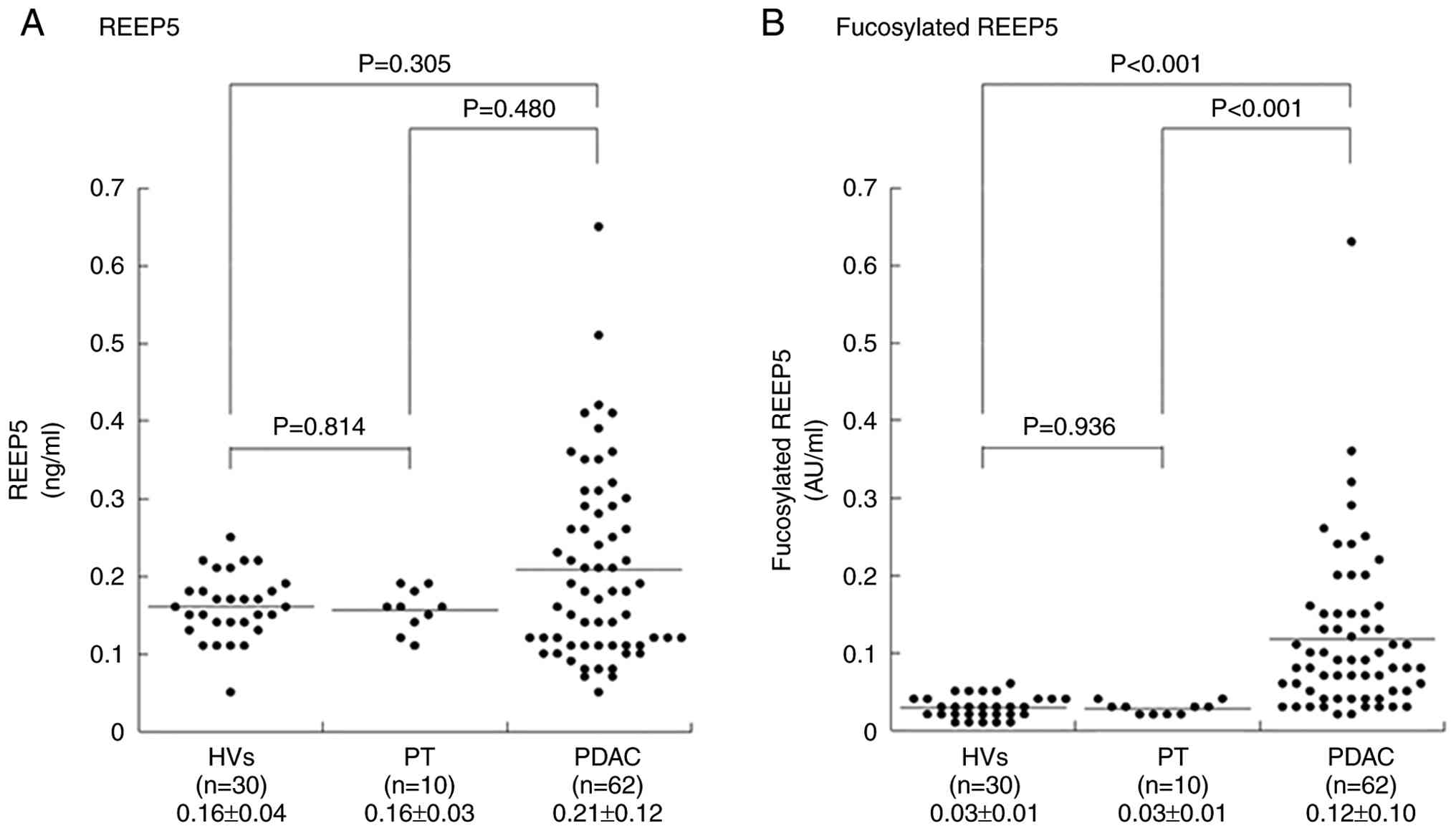 REEP5 and fucosylated REEP5 levels in
HVs and in PT and PDAC. (A) Serum REEP5 levels in the third cohort
were 0.16±0.04, 0.16±0.03 and 0.21±0.12 ng/ml in HVs, PT and PDAC,
respectively. (B) Serum fucosylated REEP5 levels in the third
cohort were 0.03±0.01, 0.03±0.01 and 0.12±0.10 AU/ml in HVs, PT and
PDAC, respectively. HVs, healthy volunteers; PT, chronic
pancreatitis; PDAC, pancreatic ductal adenocarcinoma; REEP5,
receptor expression-enhancing protein 5.