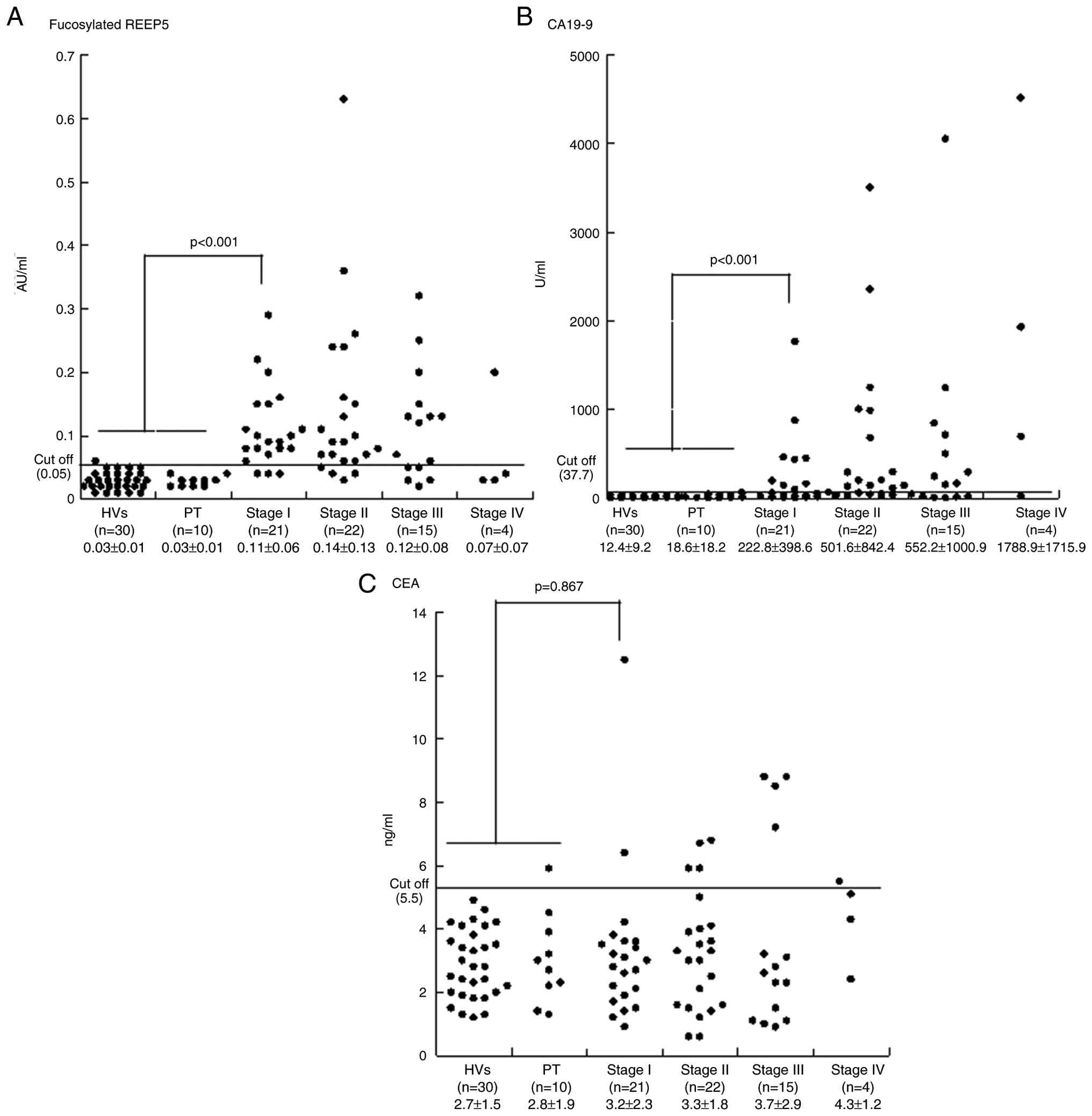 Fucosylated REEP5, CA19-9 and CEA
levels in HVs and patients with chronic pancreatitis and PDAC
(stage I–IV). (A) Serum fucosylated REEP5, (B) serum CA19-9 and (C)
serum CEA levels in the third cohort. REEP5, receptor
expression-enhancing protein 5; CA19-9, carbohydrate antigen 19-9;
CEA, carcinoembryonic antigen; HVs, healthy volunteers; PDAC,
pancreatic ductal adenocarcinoma.